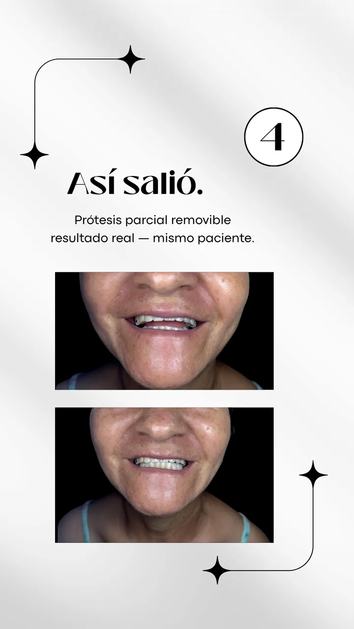Lámina 5 de 6: Así salió. Resultado real, mismo paciente.