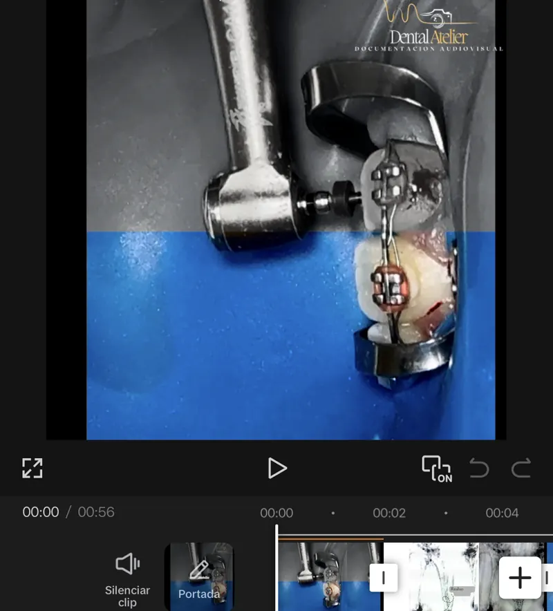 Captura de la edición del reel en el celular, con la portada elegida